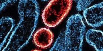 Virus Nipah: ¿Qué es?